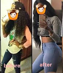 Bioxelan Skin Care Online, Bioxelan Health And Beauty Online In Kenya, Bioxelan Cream In Nairobi Kenya, Bioxelan Products Shop, Bioxelan Cream Price KE, Bioxelan Side Effects, Bioxelan Reviews KE