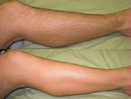 depilage cream jumia depilage price depilage kenya depilage side effects depilage cream reviews depilage how to use depilage hair removal reviews depilage hair removal price depilage price watsons where to buy depilage hair removalcream in kenya Nairobi Kenya daresalaam tanzania juba south sudan Khartoum sudan Kigali Rwanda kampala Uganda bunjumbura Burundi kinshasaDRC depilage hair removal cream Maputo Mozambique accra Ghana Dakar Senegal Lusaka Zambia Monrovia angola jibouti asmara Eritrea tunis Tunisia rabat morocco cairo Egypt Harare zimbambwe diaremedium Mauritius Seychelles Pretoria south Africa depilage cream lagos Nigeria detox and body cleansing products shop capeverde eguitorial guinea mogadishu Somalia adisababa Ethiopia togo Liberia sierraleone depilage products shop africa +254723408602