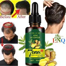 today's mega jackpot bonus kenya, 7 Days Hair Regrowth