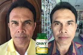 herbal slimming pills in nairobi, Onny Collagen Supplements Capsule
