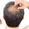 where to buy Insumed Supplement in Nairobi, Mayahn Anti Balding Cream
