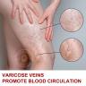 diaboost supplement in kenya, Varicose Veins Treatment Cream