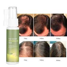 cardioactive blood pressure support in kenya, Grofast Hair Growth Spray
