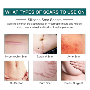Instant Toothache Pain Relief Spray, Silicone Scar Sheets