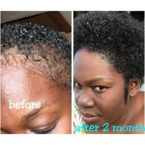 parasi cleaner reviews, parasi cleaner ingredients, parasi cleaner dosage, parasi cleaner side effects, parasi cleaner contacts in kenya, Leave-in Rice Hair-Growth Spray