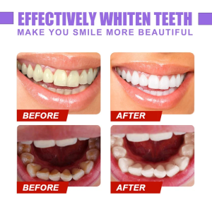Insulinol Buy | Original Product, Insulinol Capsule for Diabetesin Nairobi, teeth colour corrector serum