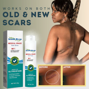 bioforce kenya, flexibility joint cream, hondrostrong Forte Cream, PerfectX Joint Cream, Flekosteel Cream, Flexogor Gel, Sustafix Cream, Motion Energy Cream, Medical Grade Scar Spray 