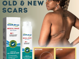 medical operation scar removers near me nairobi