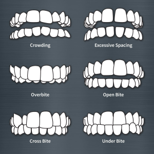 Bioforce in Kenya,Bio Force Arnica Cream,
arthritis medicine in kenya,Bioforce in kenya Buy, DENTALIGN™ Teeth Aligner Brace,Bioforce Kenya cream is 100% natural,Buy Bioforce Products Online at Best Prices