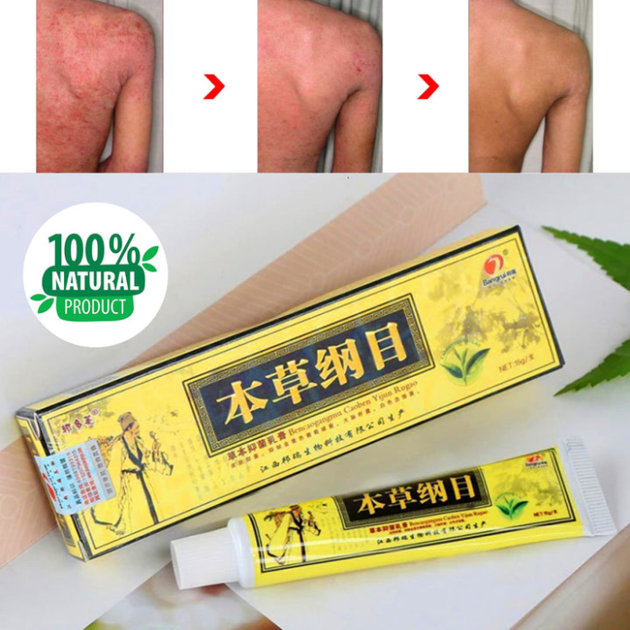 ECZEMA NATURAL CREAMS IN KENYA