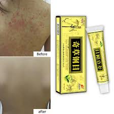matcha tea for sale near me kenya,Sexual Wellness,Erection Pills for Men,sawa power male enhancement capsules,prostamexil,lidoria goodman oil for enlargement, alpha beast capsules, titan gel, hotshot capsules, vipromac capsules, vigorense, actipotens, prostaline, prosta plus, manplus xxxl, longjack xxxl kenya