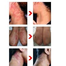 prostaline capsules for sale near me kenya,male enhancement gels near me nairobi, titan gel, Mk Oil, Lidoria Goodman Enlargement Oil, Jaguar 3 in 1 gel, Shark power cream, largo cream, strongman cream, prosolution male enhancement cream, viga cream for men, stud