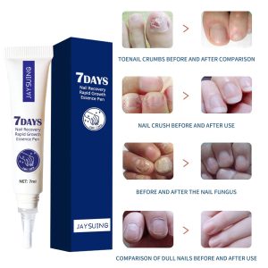 Where to buy Delay Sprays In Kenya? 7days Nail Recovery Serum Health Supplements Kenya is the place to shop. Because, the service for the customer is pleasant. In addition, you can call them using telephone number +254723408602. However, you can visit their office in 2nd Floor Of Nacico Coop Chamber On Mondlane Street Opposite Imenti House.