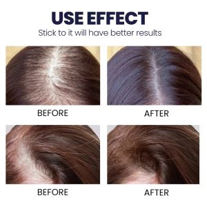 Where can I buy Diabextan Blood Sugar Nutritional Supplement? Feg Hair Growth Spray, asami hair spray price Health Supplements Kenya is the place to shop. In addition, the service for the customer is pleasant. You can call them using telephone number +254723408602. Alternatively you can visit their office in 2nd Floor Of Nacico Coop Chamber On Mondlane Street Opposite Imenti House.