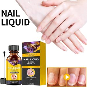 buy Insulinol Diabetes Capsules In Kenya? Bee Venom Nail Treatment Healthsupplementskenya is the place to shop. In addition, the service for the customer is pleasant. You can call them using telephone number +254723408602. However, you can visit their office in 2nd Floor Of Nacico Coop Chamber On Mondlane Street Opposite Imenti House.