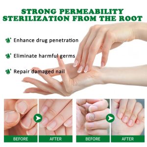 Where can I buy Longjack XXXL In Kenya? Bee Venom Nail Treatment Health Supplements Kenya is the place to buy Longjack XXXL Capsules. Because, the service for the customer is pleasant. In addition, you can call them using telephone number +254723408602. However, you can visit their office in 2nd Floor Of Nacico Coop Chamber On Mondlane Street Opposite Imenti House.