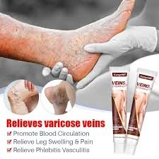 buy Bioforce Joint Gel? Varicose Veins Removal Cream
Health Supplements Kenya is the place t
