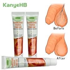 Diabetin Capsules For Supporting Healthy Blood Sugar Levels In Kenya, Varicose Veins Removal Cream