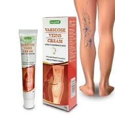 heartkeep online, Varicose Veins Removal Cream