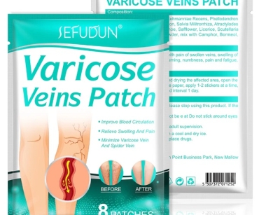 Best treatment for varicose veins Varicose vein treatment cost When to worry about varicose veins Varicose veins treatment medicine Varicose veins Treatment Cream Varicose vein treatment near me Latest treatment for varicose veins varicose veins self-care